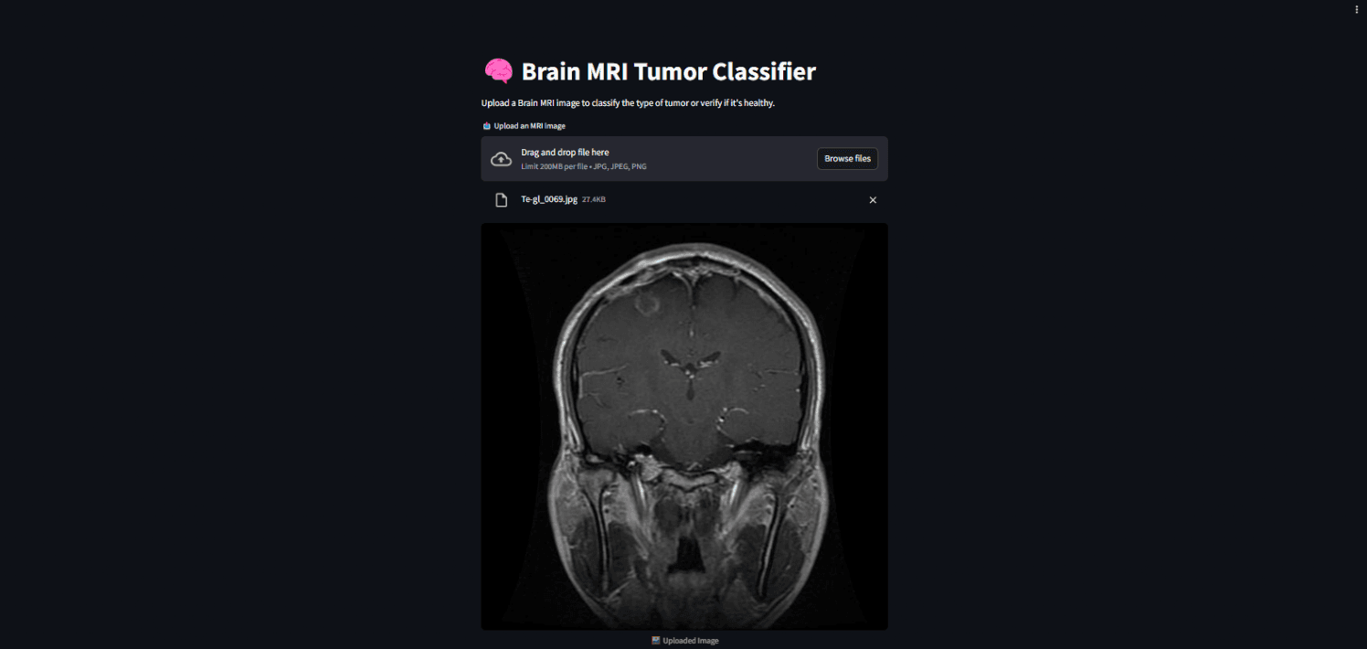 Brain tumor MRI classification model